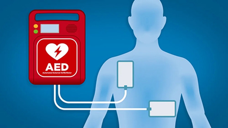 automated external defibrillator definition