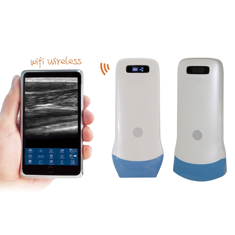 mobil ultraljud kostnad