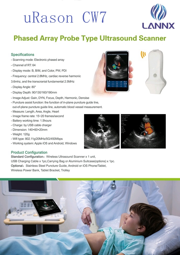 sonda de ultrasonido de embarazo