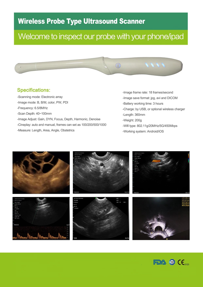 cosgais transvaginal ultrasound