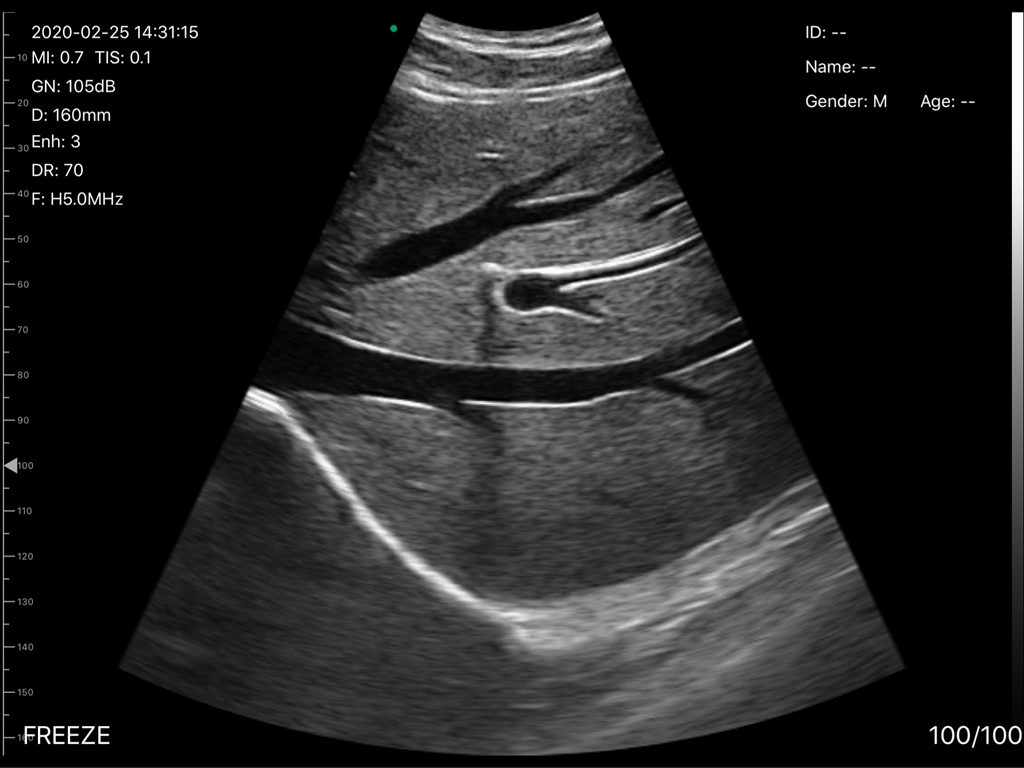 ultrasound usg sojntsuam nqi