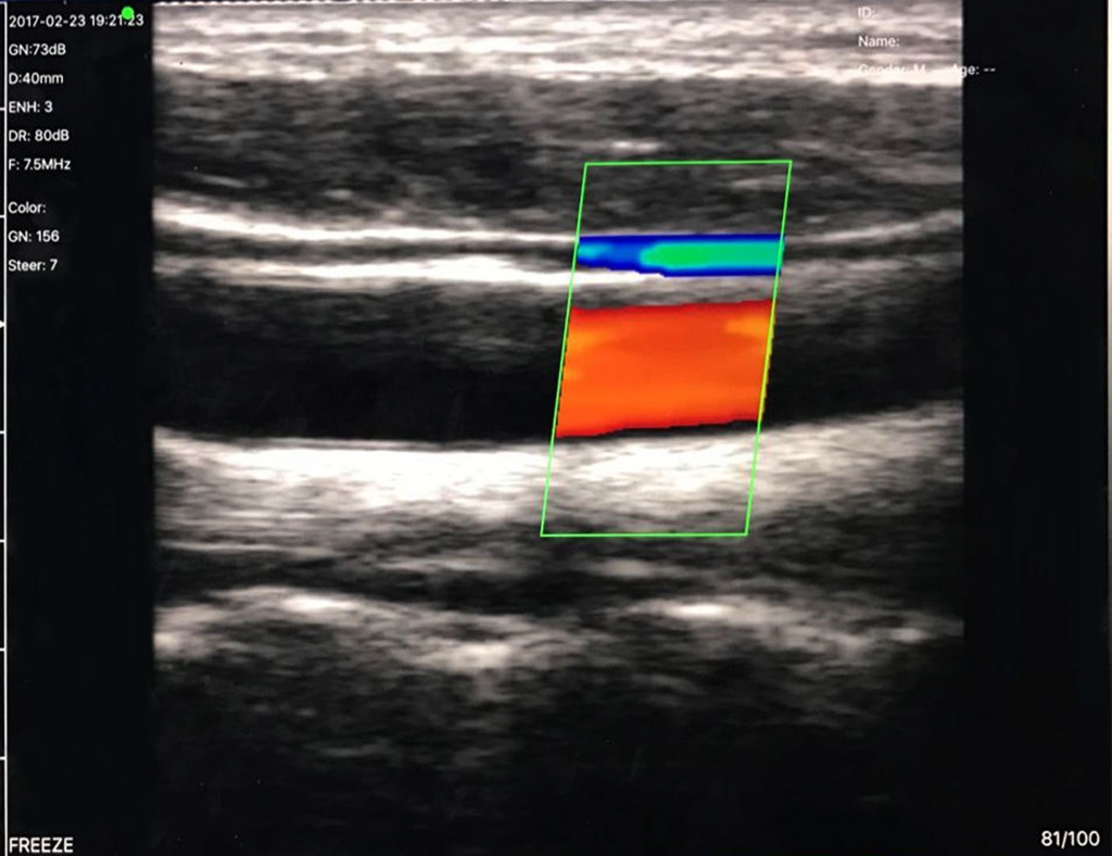 b modu ultrasonun kullanım alanları