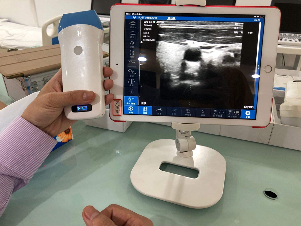 Drahtloser Ultraschall für das iPhone
